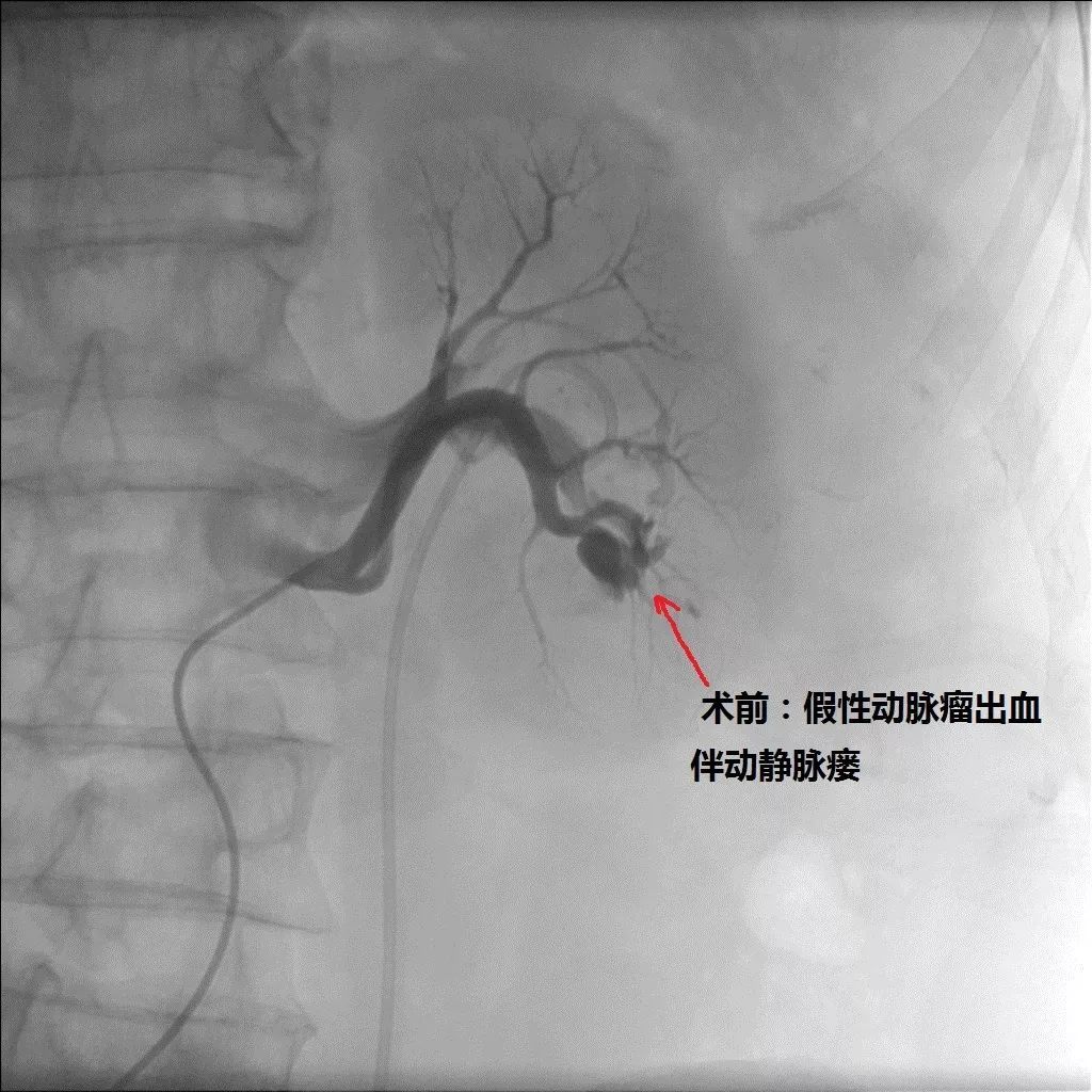 加拿大多伦多市发生2起枪击事件 造成3人死亡‘太阳成官网’(图2) 太阳成集团tyc